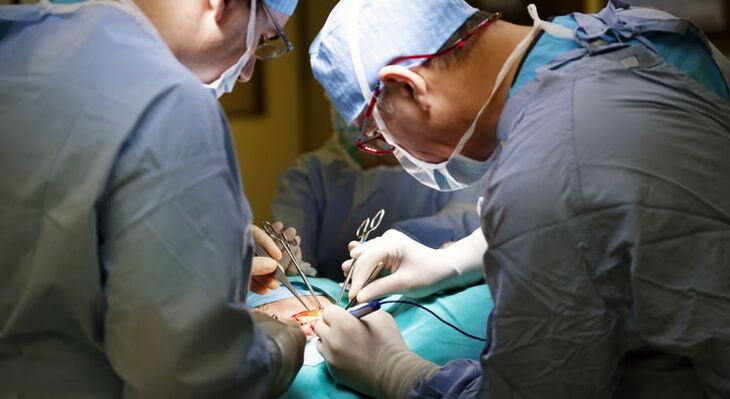 Surgery is performed in advanced stages of chronic prostatitis in men. 